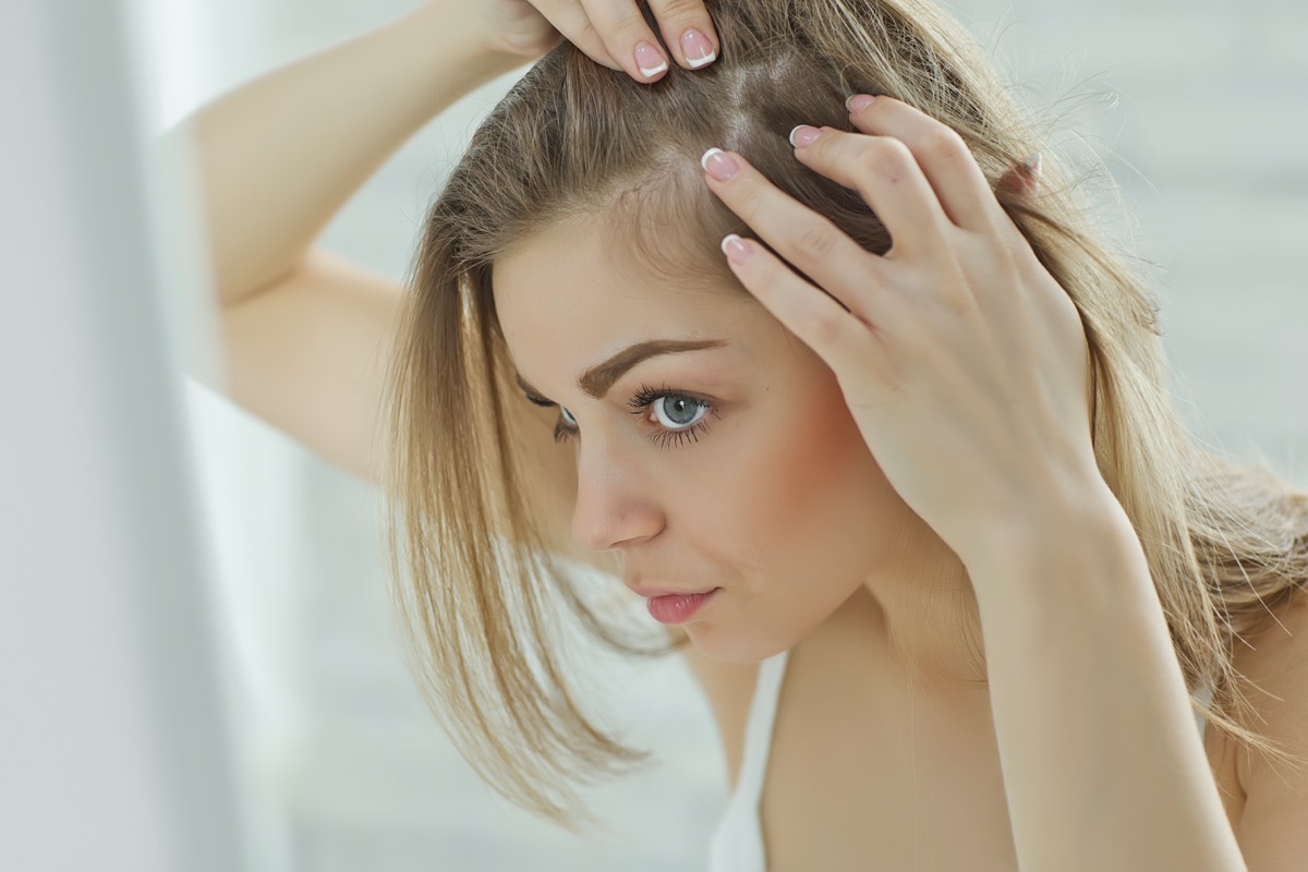 6 Nutritional Deficiencies That Can Cause Hair Loss  Whats Good by V