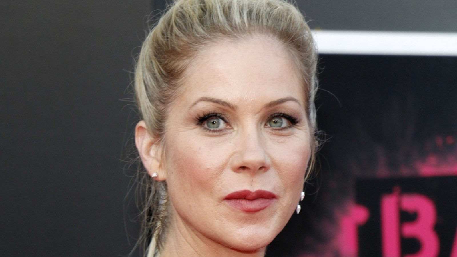 5 Signs You May Have Multiple Sclerosis, Like Christina Applegate | Eat ...