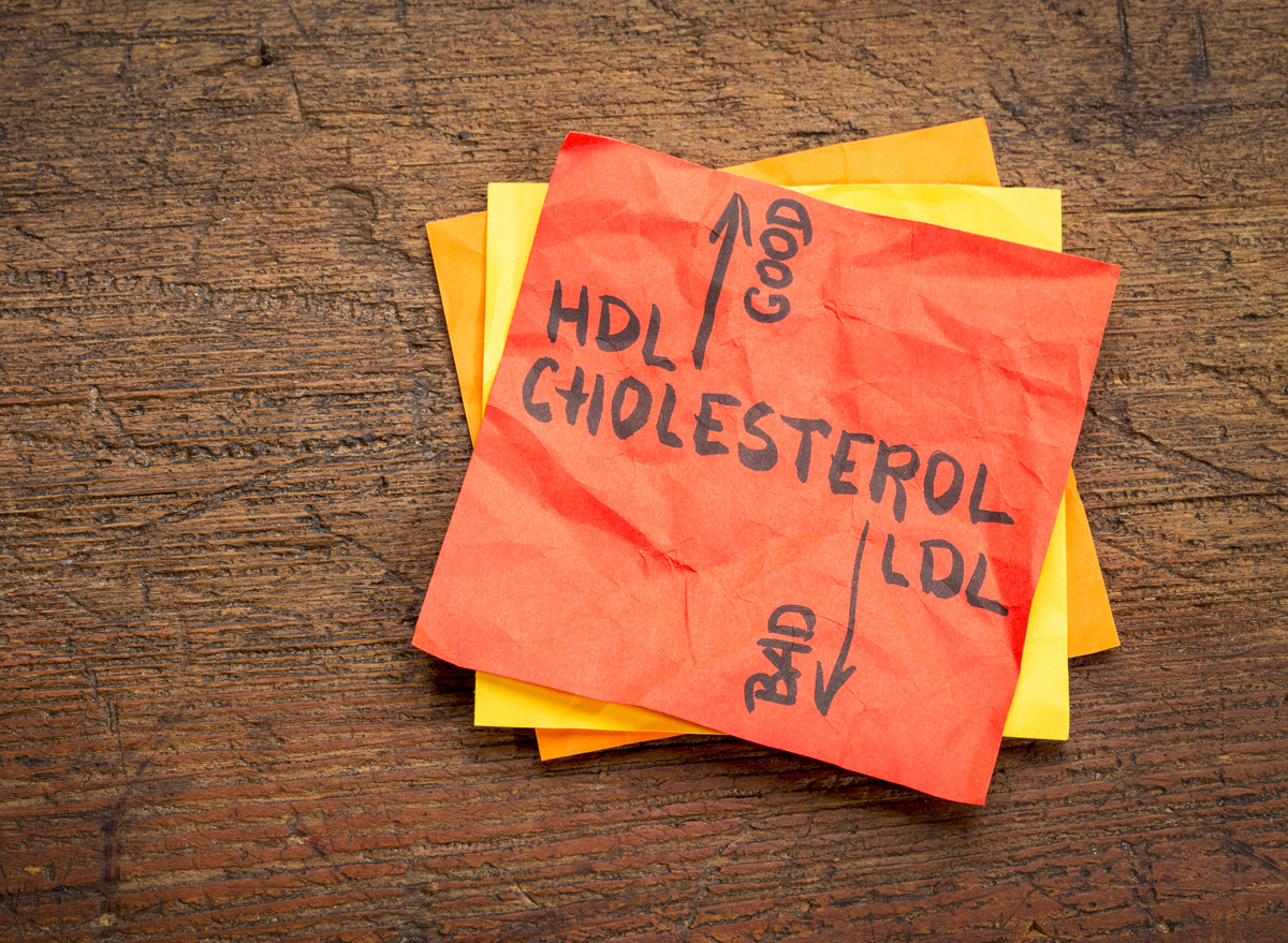 Cholesterol Levels: High, Low, Good & Bad