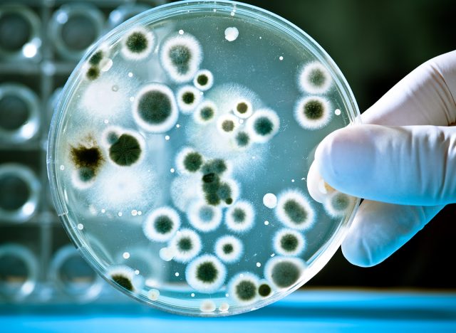 Gloved hand holding a Petri dish, listeria 