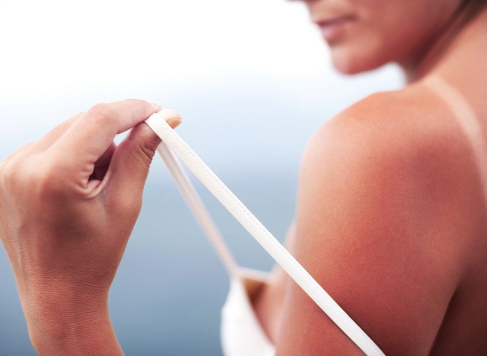 7 Foods To Eat To Prevent Sunburn Eat This Not That